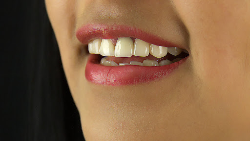 Consultorio Dental en Miraflores | Dra. Andrea Contreras