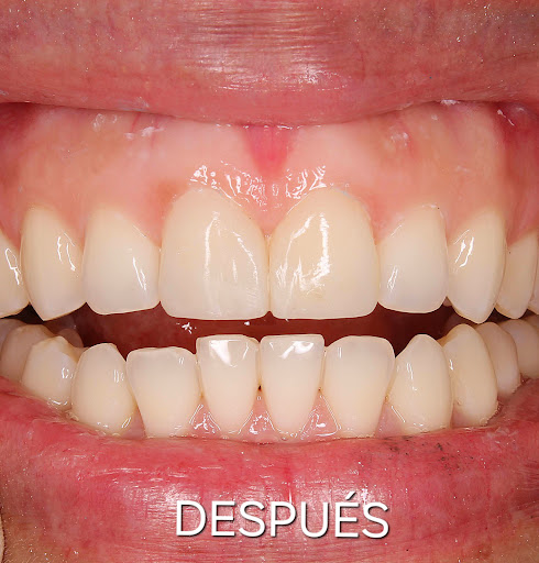 Odontoplanners - Ortodoncia, Diseño de Sonrisa, Implantes y Rehabilitación Oral Lima
