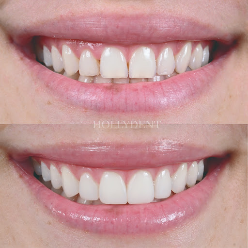 Clinica Odontológica Hollydent