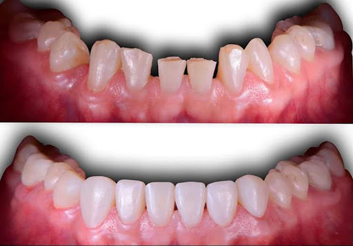 Dental Perfectime San Luis