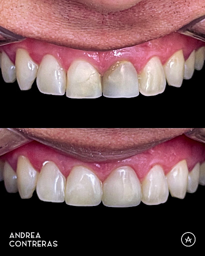 Consultorio Dental en Lima | Cerca de Mi | Dra. Andrea Contreras