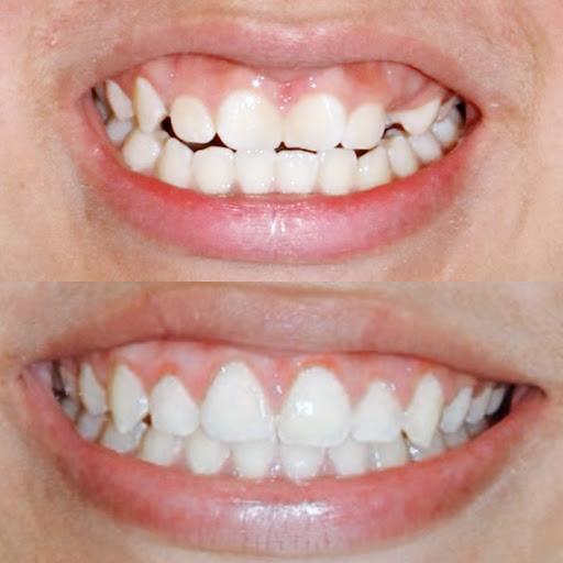 DENTUM - Clínica Dental, BRACKETS, Ortodoncia, Odontólogos, INVISALIGN, Dentistas, Curaciones Dentales en Niños, San Miguel