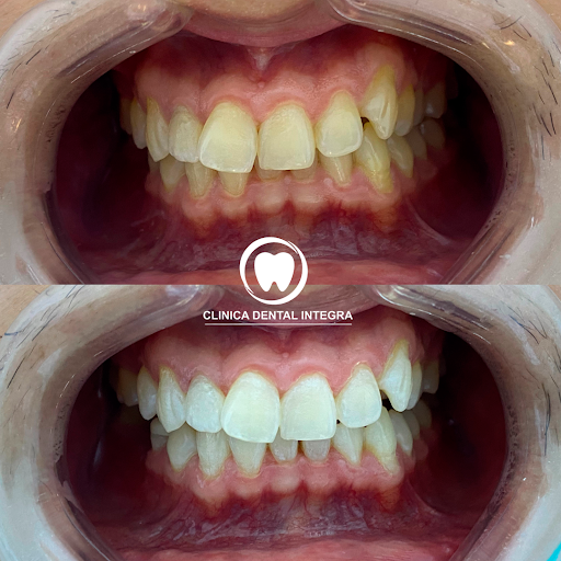 Clínica Dental Integra - San Miguel