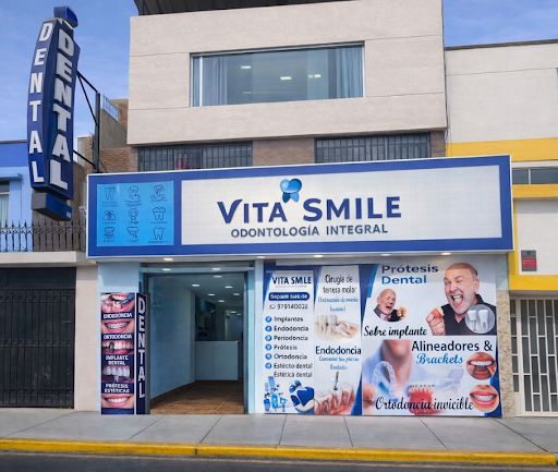 Dentista Santa Anita - Alineadores Invisibles, Implantes Dentales , Brackets, Odontología Integral