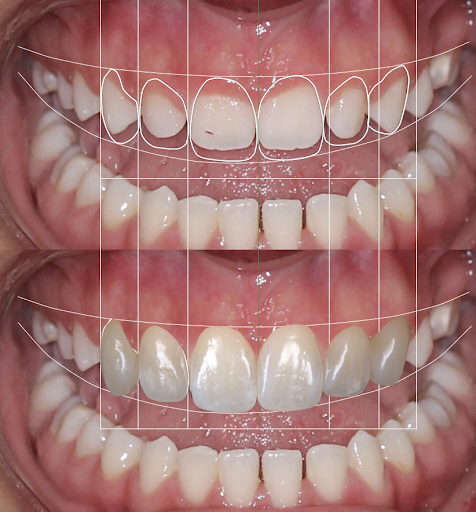 BlueSmile Perú - Clínica dental Magdalena del Mar