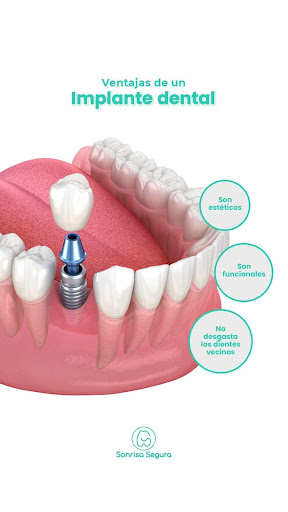 Sonrisa Segura Villa El Salvador