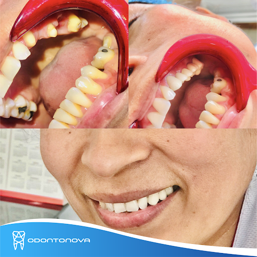 Centro Dental Odontonova