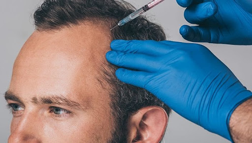 Capilar Center - Centro de Implante Capilar