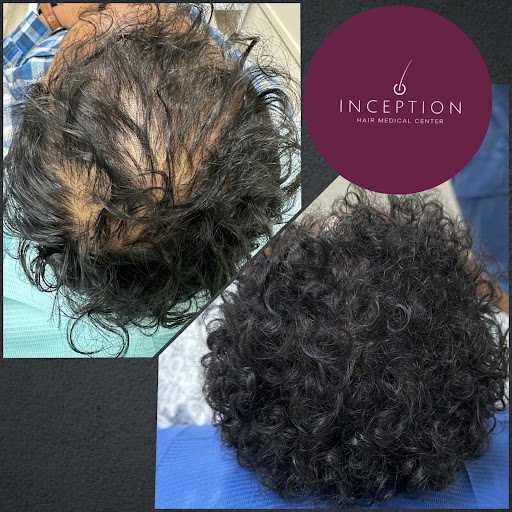 Inception Hair Medical Center