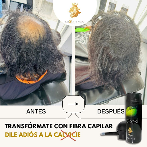 LUXURY MEN- Solución Capilar Perú