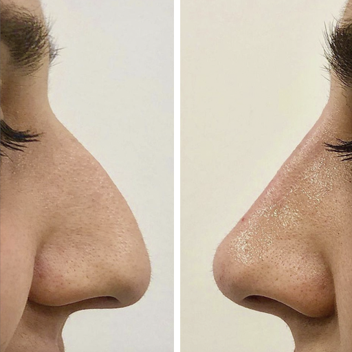 Imebelle Lima Clínica Estética y Depilación Láser