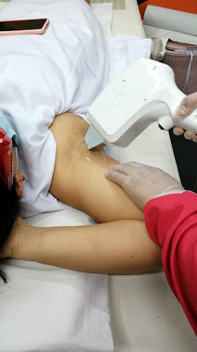 Radiance – Depilación Láser (Spa)