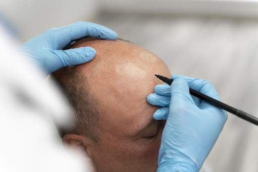 Facelook Esthetic Scalp Clinic
