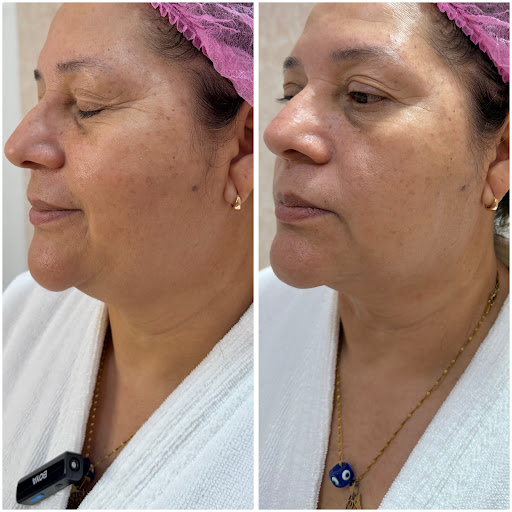 ebr estetica integral