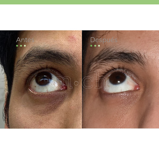 MCH Medicine & Wellness | Medicina Estética | Ginecología Lima- Perú
