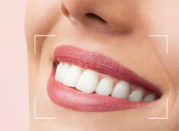 Clínicas de Diseño de Sonrisa en Rímac
