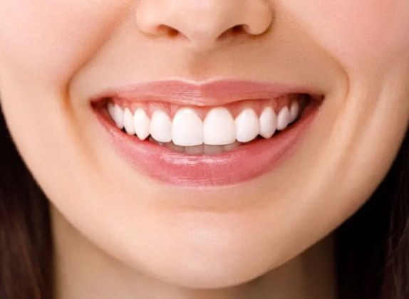 Clínicas de Diseño de Sonrisa en San Juan de Lurigancho