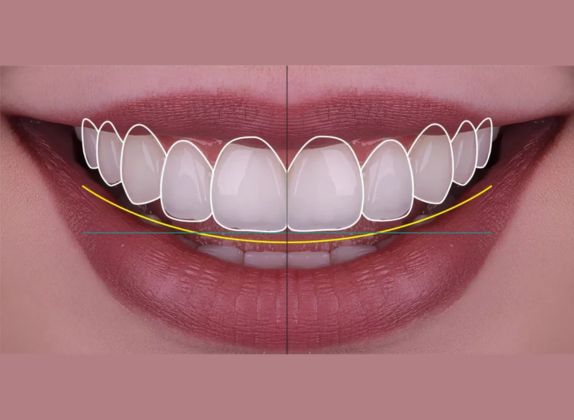 Clínicas de Diseño de Sonrisa en San Juan de Miraflores
