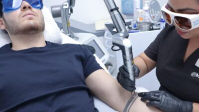 Clínicas de Eliminación de Tatuajes en Los Olivos